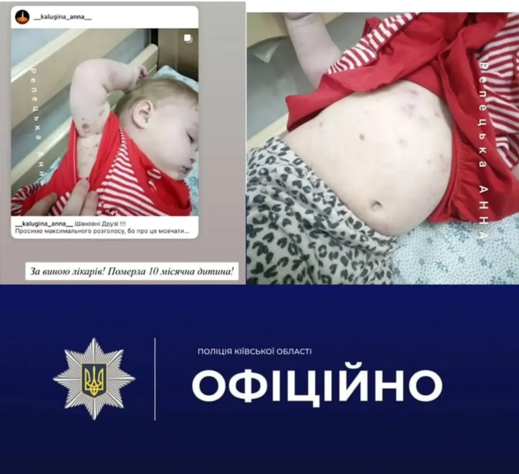 У Білій Церкві поліція розслідує смерть немовляти у дитячій лікарні